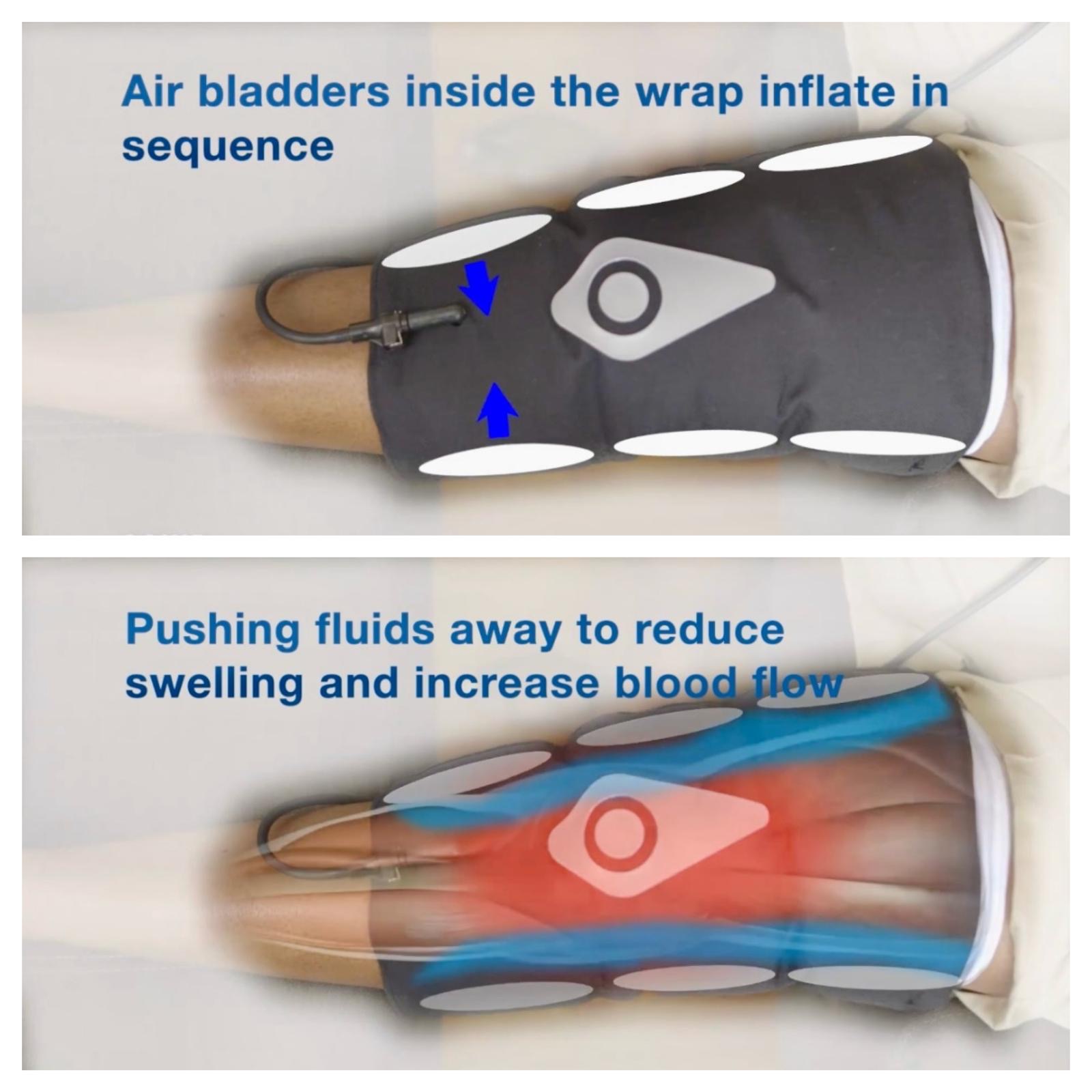 Air bladders inside the wrap inflate in sequence, pushing fluids away to reduce swelling and increase blood flow